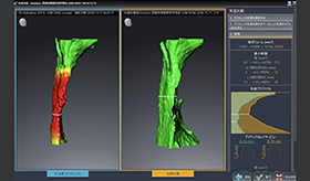 閉塞性睡眠時無呼吸症(OSA)治療について